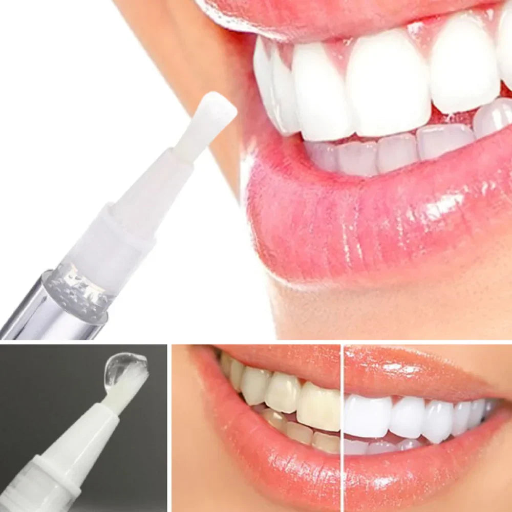 1+1 GRATIS | Pióro do wybielania zębów Diamond Smile
