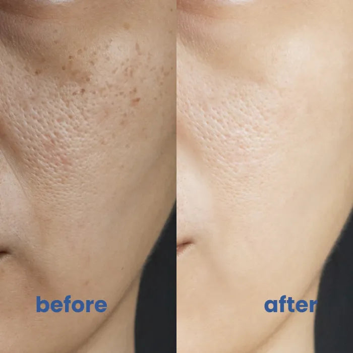 Idealne rozwiązanie do pokrycia