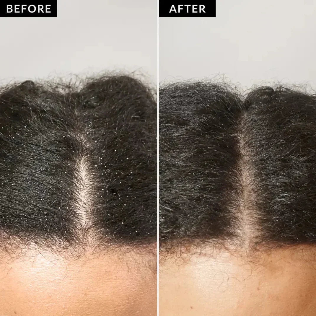 Grzebień do Detoksykacji Skóry Głowy