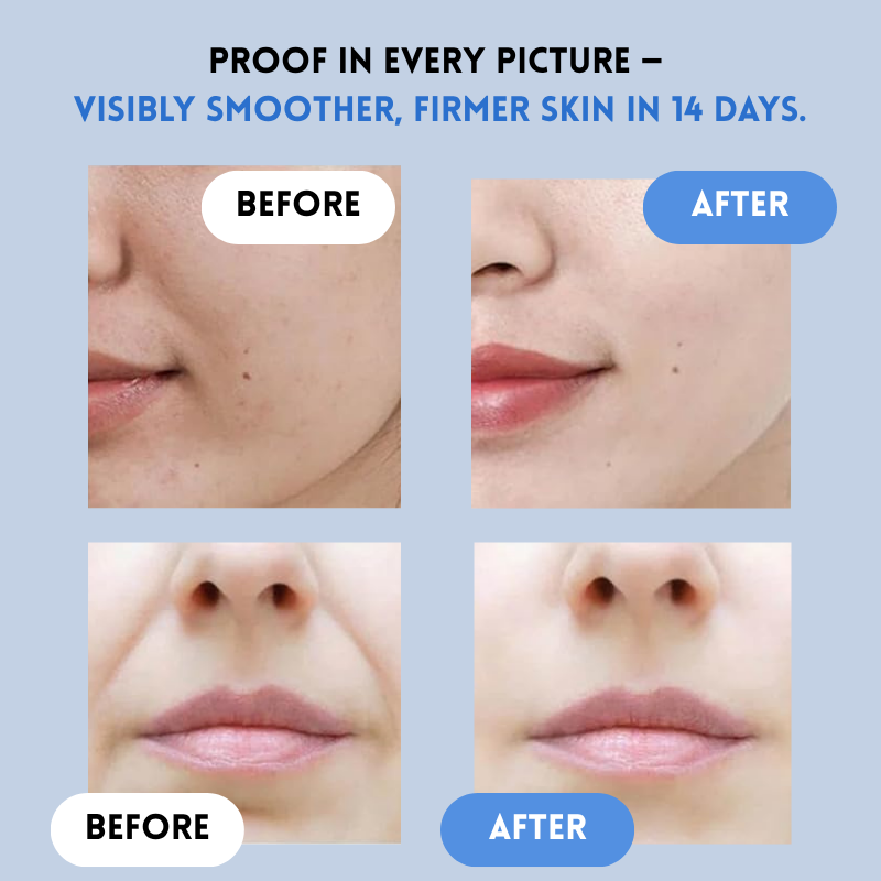 YouthLift™ Odnów paski – Natychmiastowe rozwiązanie dla ponadczasowego piękna