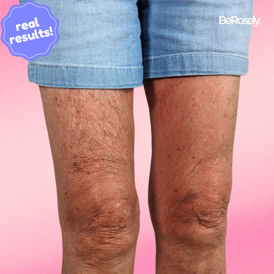 SilkSkin - Nienaganne nogi w kilka sekund (10+5 GRATIS | 20+10 GRATIS)