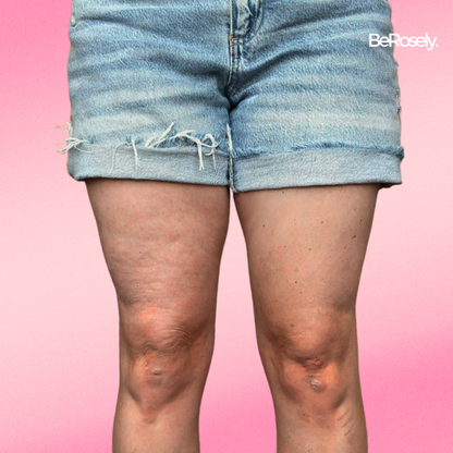 SilkSkin - Nienaganne nogi w kilka sekund (10+5 GRATIS | 20+10 GRATIS)